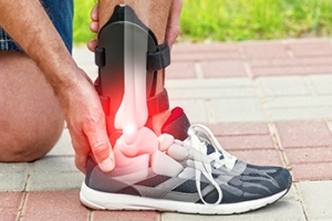 Use of Braces for Ankle Sprains
