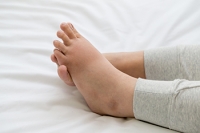Sore and Swollen Feet During Pregnancy